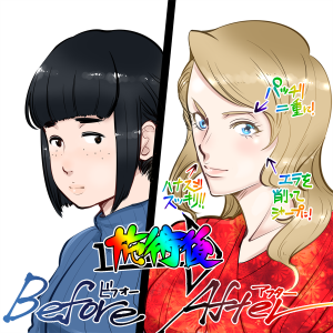 美容整形で美人になる。ビフォーアフター。